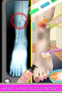 Leg Surgery Doctor Screen Shot 1