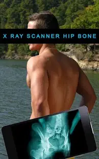 X ray Scanner Hip Bone Screen Shot 1