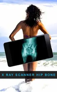 X ray Scanner Hip Bone Screen Shot 4