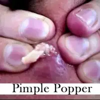 Pimple Popper Puzzle Screen Shot 1