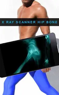 X ray Scanner Hip Bone Screen Shot 5