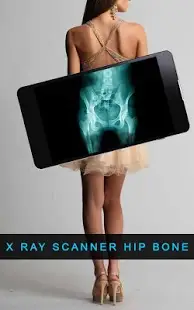 X ray Scanner Hip Bone Screen Shot 2