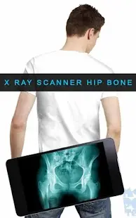 X ray Scanner Hip Bone Screen Shot 3