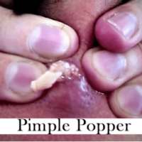 Pimple Popper Puzzle