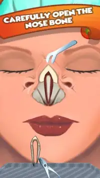 Nose Surgery ER Simulator Lite Screen Shot 4