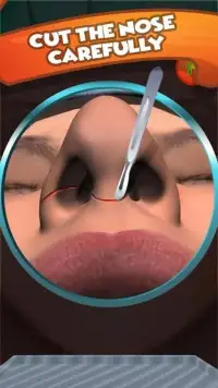 Nose Surgery ER Simulator Lite Screen Shot 5