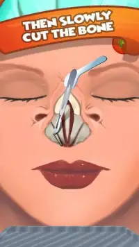Nose Surgery ER Simulator Lite Screen Shot 3