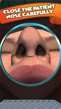 Nose Surgery ER Simulator Lite Screen Shot 0