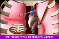 Viking Bone Doctor: Caveman Operate Now Hospital Screen Shot 4