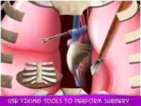 Viking Bone Doctor: Caveman Operate Now Hospital Screen Shot 0