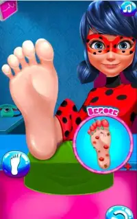 Game Master Bedah Ladybug Nail_Foot Ajaib Screen Shot 4