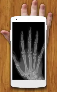 X-ray Scanner Prank Screen Shot 1