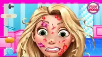 Cure face princess Rapunzel - Medical Kids Game Screen Shot 2