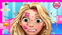 Cure face princess Rapunzel - Medical Kids Game Screen Shot 1